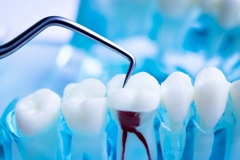 5 Signs You Cracked a Tooth