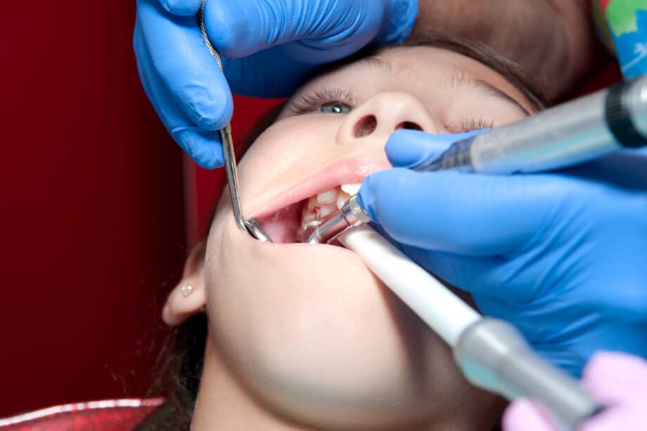 Can a Root Canal Be Done in One Visit?